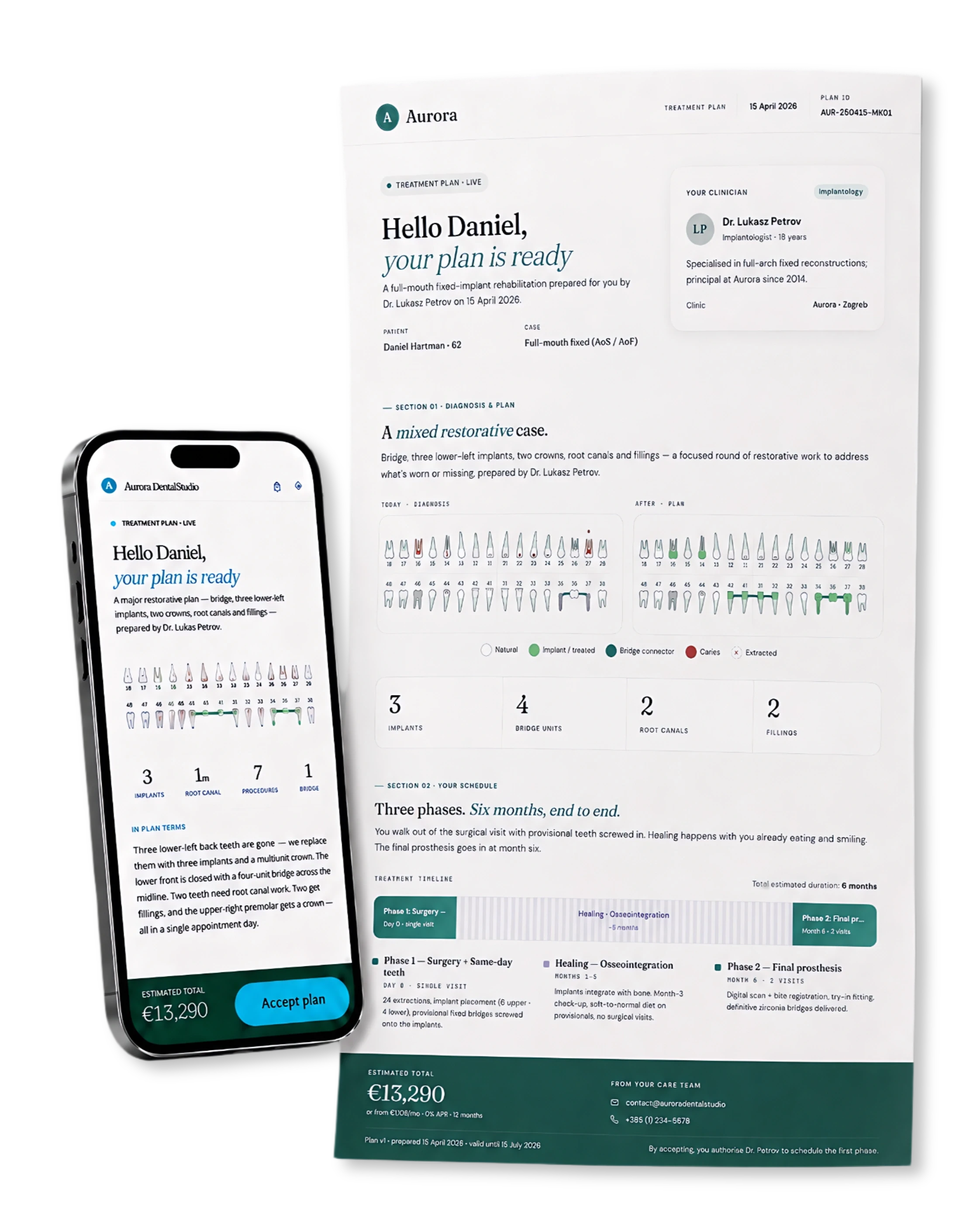 Plandentic mobile treatment plan preview - patient view with tooth chart, multi-phase plan, and accept-on-mobile call to action